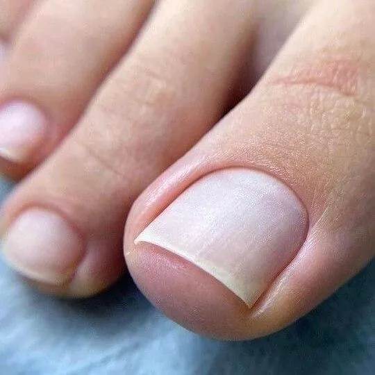 Pedicura sin esmalte en Aventura FL